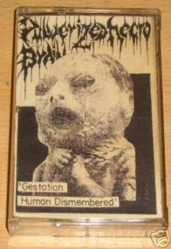 Gestation Human Dismembered